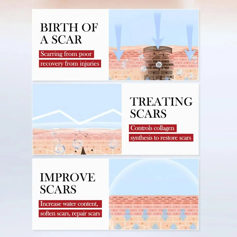 SADOER Scar Repair Cream Repairing Scald Moisturizing Rejuvenating Hydrating Firming Face Cream Facial Skin Care Products