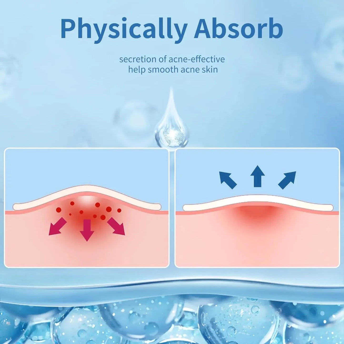 24pcsHydrocolloid Acne Stickers Daily Skincare Spot Covers Gentle Non-Drying, Individually Packaged, Waterproof & Oil-Absorbing