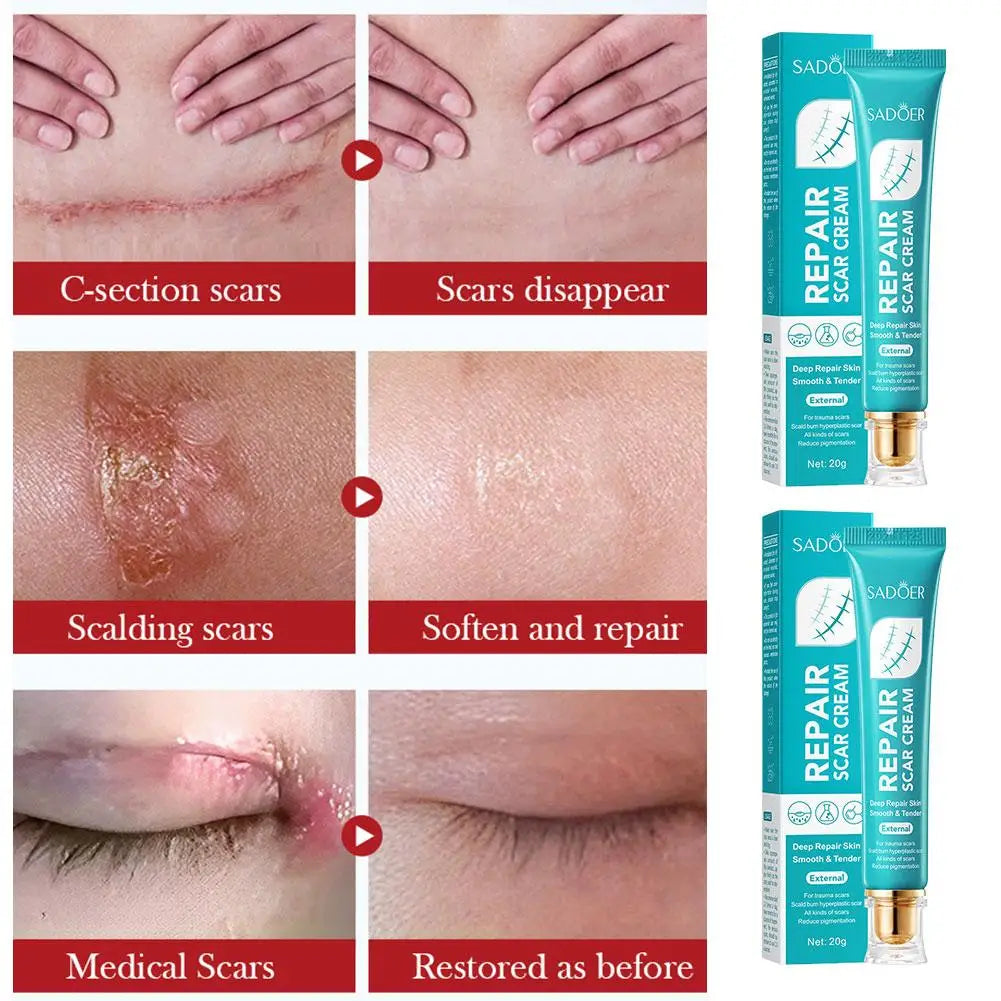 SADOER Scar Repair Cream Repairing Scald Moisturizing Rejuvenating Hydrating Firming Face Cream Facial Skin Care Products