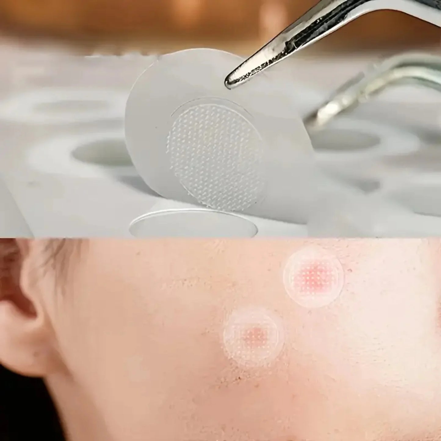 24pcsHydrocolloid Acne Stickers Daily Skincare Spot Covers Gentle Non-Drying, Individually Packaged, Waterproof & Oil-Absorbing