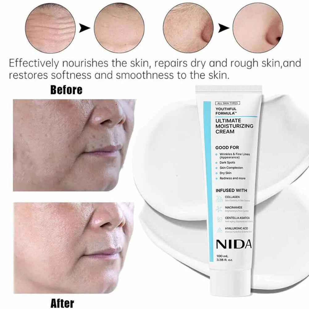 Nida Ultimate Moisturizing Facial Cream Nourishing Even Skin Tone Reduce Dark Spot Collagen Niacinamide Hyaluronic Acid Skincare