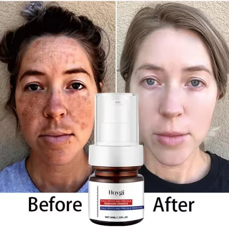 Collagen Face Cream Firming Lifting Fine Line Deep Anti Sagging Wrinkle Anti-Aging Products Brighten Serum Korean Skin Care Set